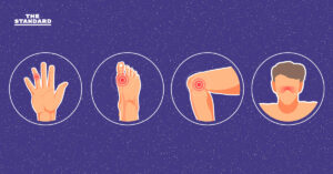 Arthritis Symptoms causes