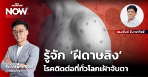 ฝีดาษลิง