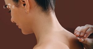 ฝังเข็มแบบ Dry Needling