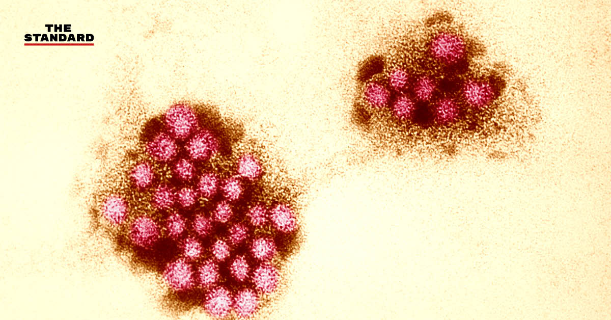 norovirus-outbreak-how-to-handle-news