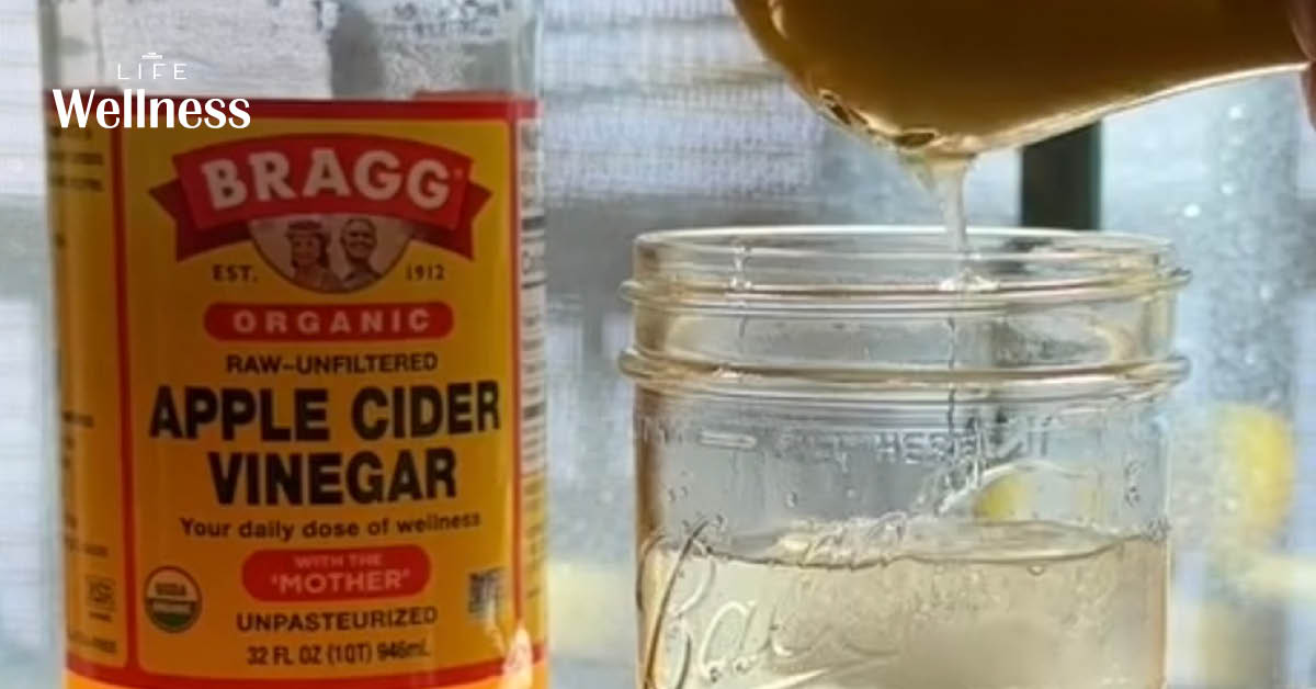 ขวด Apple Cider Vinegar แบบมี The Mother พร้อมตะกอนในขวด