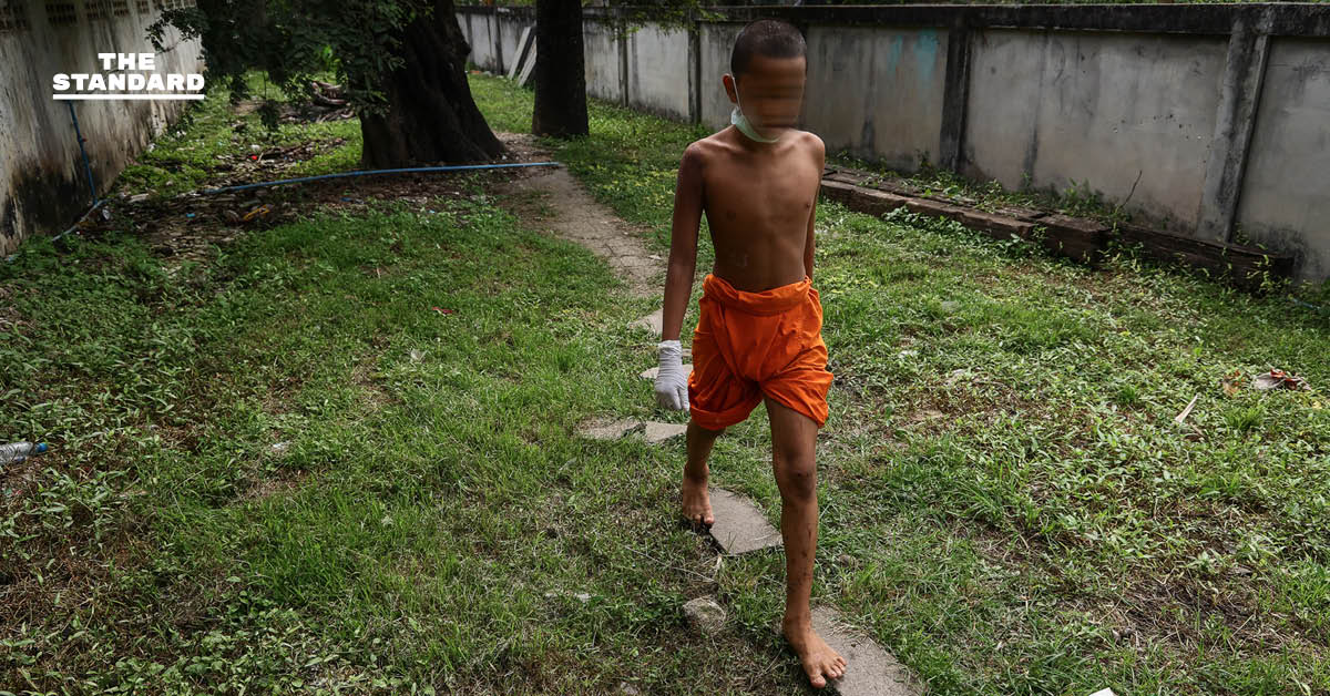 The headline already adheres to the Khaosod/Thairath spacing rule as there are no proper nouns immediately following a verb in this sentence. Therefore, no changes are needed. **Original Headline:** ชีวิตของเด็กใต้ร่มศาสนา เมื่อเณรต้องกลายเป็นผู้ลี้ภัย **Reformated (No Change Needed):** ชีวิตของเด็กใต้ร่มศาสนา เมื่อเณรต้องกลายเป็นผู้ลี้ภัย