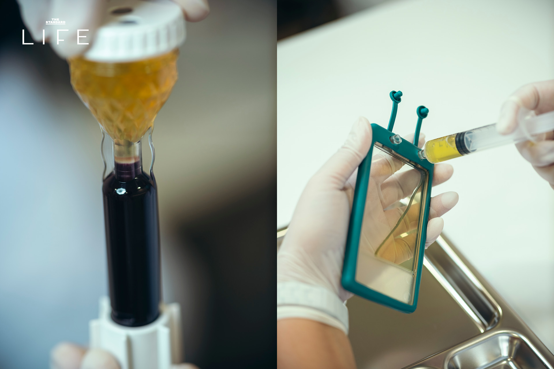 เจาะลึก MCT กับ Dr.Park นวัตกรรมใช้เลือดตัวเองซ่อมผิวที่ Kim Kardashian บินทำถึงเกาหลี 6