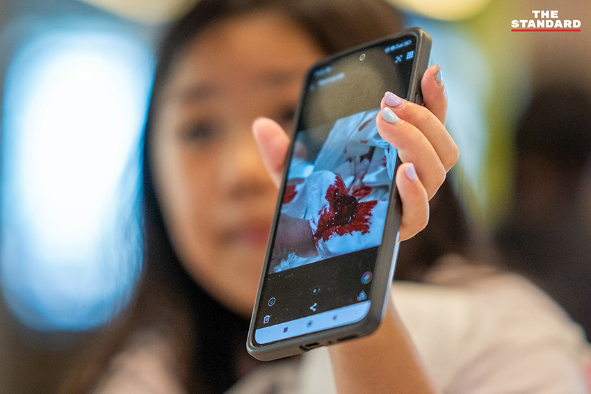 ภาพประกอบ: เด็กหญิง ‘มะนาว’ วัย 8 ขวบ เชียงใหม่ ประสบปัญหาเลือดกำเดาไหลจากฝุ่น PM2.5 1