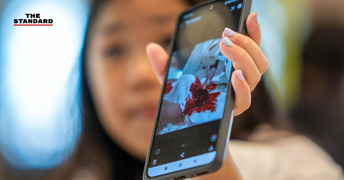 ภาพประกอบ: เด็กหญิง ‘มะนาว’ วัย 8 ขวบ เชียงใหม่ ประสบปัญหาเลือดกำเดาไหลจากฝุ่น PM2.5