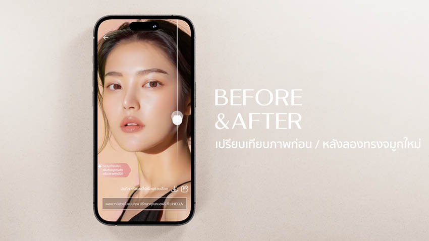 รูปภาพแสดงนวัตกรรม “My EMMA NOSE” ซึ่งเป็นแพลตฟอร์ม AI+AR ช่วยให้ผู้ที่ต้องการทำศัลยกรรมจมูกสามารถลองทรงจมูกใหม่ได้เสมือนจริง 6