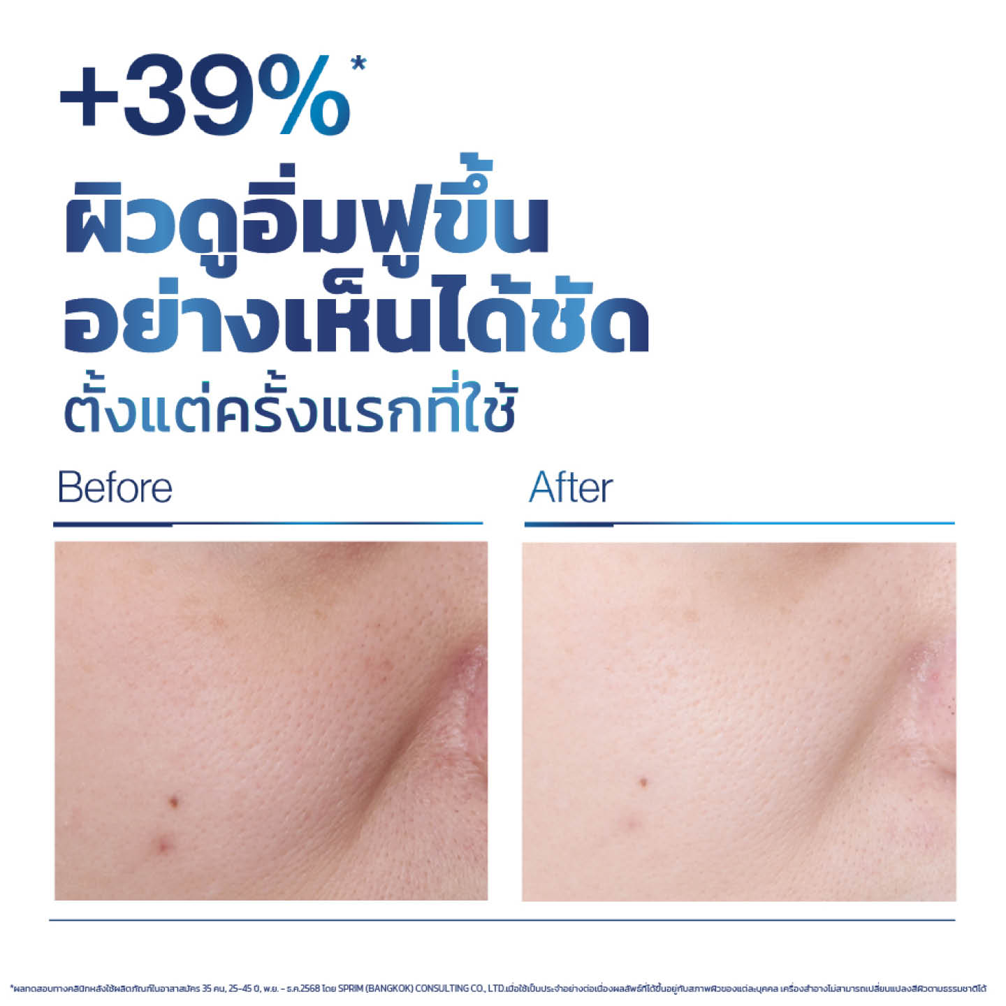 ภาพผลิตภัณฑ์ Vaseline Pro Derma ที่ช่วยลดฝ้าแดดและจุดด่างดำ 11