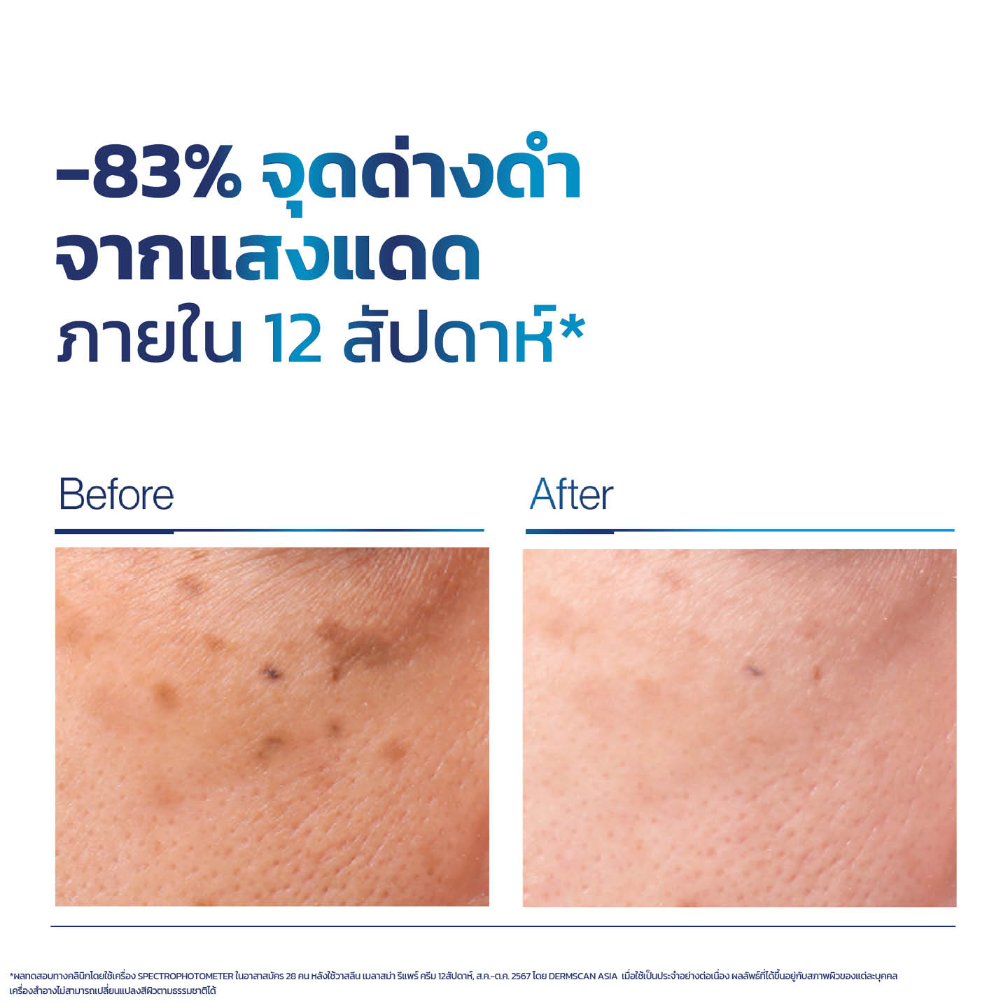 ภาพผลิตภัณฑ์ Vaseline Pro Derma ที่ช่วยลดฝ้าแดดและจุดด่างดำ 7
